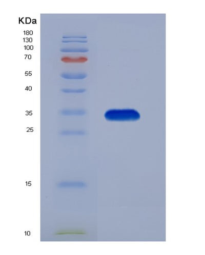 SDS-PAGE analysis of Mouse Sfrp2 (Secreted Frizzled-Related Protein 2) - Recombinant Protein, CAT# BLT-07524P, showing >90% purity under 15% SDS-PAGE (Reduced)Mouse Sfrp2 (Secreted Frizzled-Related Protein 2) - Recombinant Protein