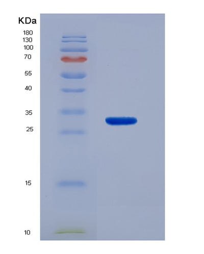 SDS-PAGE analysis of Human ACAA1 (3-Ketoacyl-Coa Thiolase, Peroxisomal) - Recombinant Protein, CAT# BLT-00022P, showing >95% purity under 15% SDS-PAGE (Reduced)Human ACAA1 (3-Ketoacyl-Coa Thiolase, Peroxisomal) - Recombinant Protein