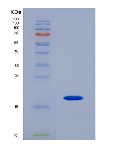 SDS-PAGE analysis of Human RBP1 (Retinol-Binding Protein 1) - Recombinant Protein, CAT# BLT-02541P, showing >85% purity under 15% SDS-PAGE (Reduced)Human RBP1 (Retinol-Binding Protein 1) - Recombinant Protein