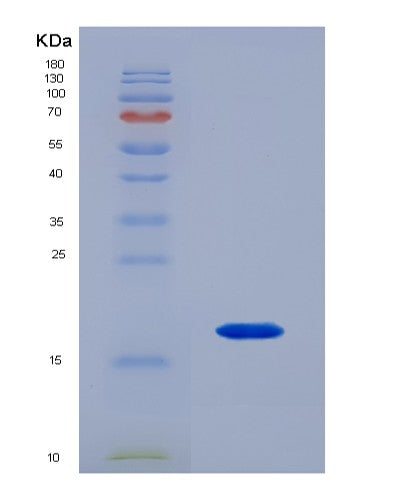 SDS-PAGE analysis of Human RBP1 (Retinol-Binding Protein 1) - Recombinant Protein, CATHuman RBP1 (Retinol-Binding Protein 1) - Recombinant Protein