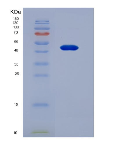 SDS-PAGE analysis of Human PAEP (Glycodelin) - Recombinant Protein, CAT# BLT-02146P, showing >90% purity under 15% SDS-PAGE (Reduced)Human PAEP (Glycodelin) - Recombinant Protein