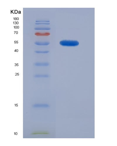 SDS-PAGE analysis of Human CLTA (Clathrin Light Chain A) - Recombinant Protein, CAT# BLT-00633P, showing >90% purity under 15% SDS-PAGE (Reduced)Human CLTA (Clathrin Light Chain A) - Recombinant Protein