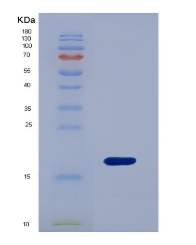 SDS-PAGE analysis of Human ANXA4 (Annexin A4) - Recombinant Protein, CAT# BLT-00162P, showing >85% purity under 15% SDS-PAGE (Reduced)Human ANXA4 (Annexin A4) - Recombinant Protein