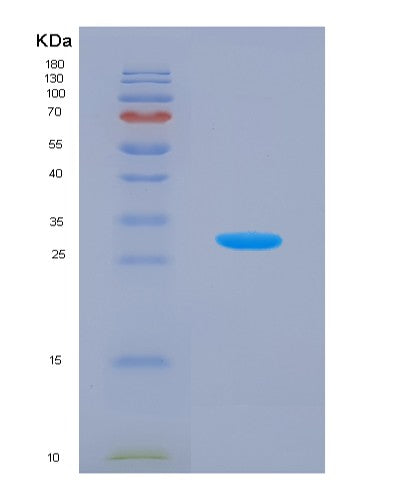 SDS-PAGE analysis of Human ALDOC (Fructose-Bisphosphate Aldolase C) - Recombinant Protein, CATHuman ALDOC (Fructose-Bisphosphate Aldolase C) - Recombinant Protein