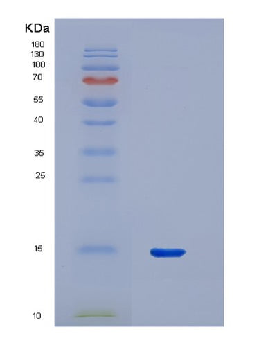 SDS-PAGE analysis of Human PPARG (Peroxisome Proliferator-Activated Receptor Gamma) - Recombinant Protein, CAT# BLT-07527P, showing >90% purity under 15% SDS-PAGE (Reduced)Human PPARG (Peroxisome Proliferator-Activated Receptor Gamma) - Recombinant Protein