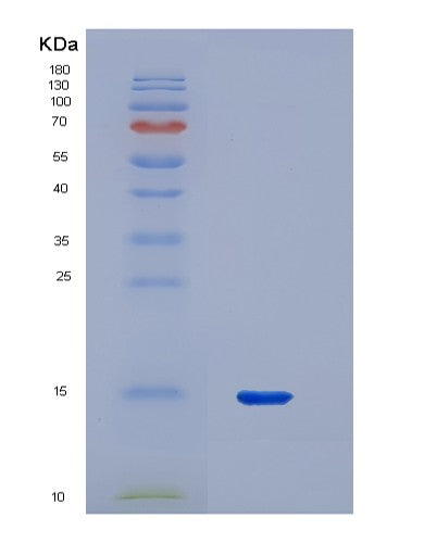 SDS-PAGE analysis of Human PPARG (Peroxisome Proliferator-Activated Receptor Gamma) - Recombinant Protein, CATHuman PPARG (Peroxisome Proliferator-Activated Receptor Gamma) - Recombinant Protein