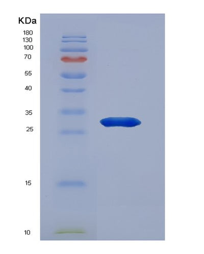 SDS-PAGE analysis of Human FBXW7 (F-Box/Wd Repeat-Containing Protein 7) - Recombinant Protein, CAT# BLT-07528P, showing >90% purity under 15% SDS-PAGE (Reduced)Human FBXW7 (F-Box/Wd Repeat-Containing Protein 7) - Recombinant Protein