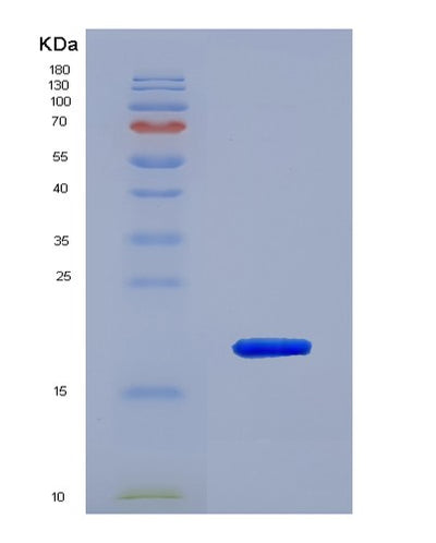 SDS-PAGE analysis of Human NOS2 (Nitric Oxide Synthase, Inducible) - Recombinant Protein, CAT# BLT-07529P, showing >90% purity under 15% SDS-PAGE (Reduced)Human NOS2 (Nitric Oxide Synthase, Inducible) - Recombinant Protein