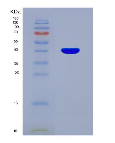 SDS-PAGE analysis of Human MAPK1 (Mitogen-Activated Protein Kinase 1) - Recombinant Protein, CAT# BLT-07530P, showing >90% purity under 15% SDS-PAGE (Reduced)Human MAPK1 (Mitogen-Activated Protein Kinase 1) - Recombinant Protein