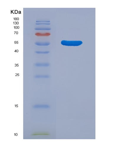 SDS-PAGE analysis of Human ALDH1A1 (Aldehyde Dehydrogenase 1A1) - Recombinant Protein, CAT# BLT-07531P, showing >90% purity under 15% SDS-PAGE (Reduced)Human ALDH1A1 (Aldehyde Dehydrogenase 1A1) - Recombinant Protein