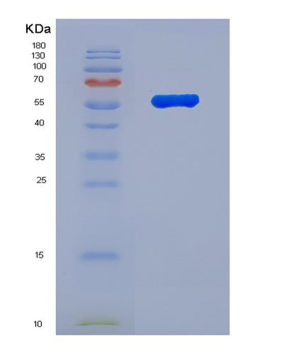SDS-PAGE analysis of Human FLG (Filaggrin) - Recombinant Protein, CAT# BLT-07532P, showing >90% purity under 15% SDS-PAGE (Reduced)Human FLG (Filaggrin) - Recombinant Protein