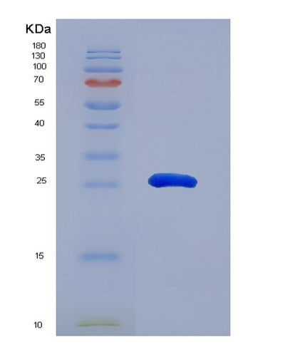 SDS-PAGE analysis of Mouse Lama2 (Laminin Subunit Alpha-2) - Recombinant Protein, CAT# BLT-07533P, showing >90% purity under 15% SDS-PAGE (Reduced)Mouse Lama2 (Laminin Subunit Alpha-2) - Recombinant Protein