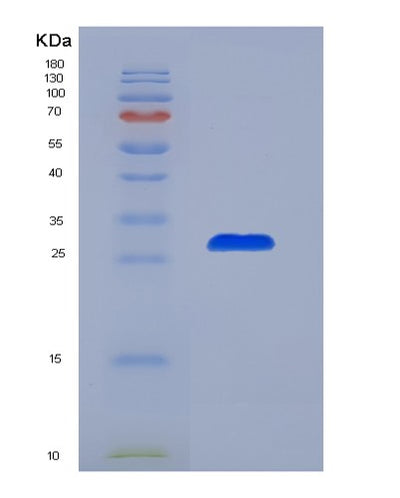 SDS-PAGE analysis of Mouse Tg (Thyroglobulin) - Recombinant Protein, CAT# BLT-07534P, showing >90% purity under 15% SDS-PAGE (Reduced)Mouse Tg (Thyroglobulin) - Recombinant Protein