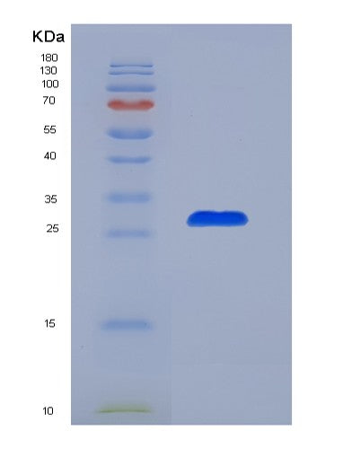 SDS-PAGE analysis of Mouse Tg (Thyroglobulin) - Recombinant Protein, CATMouse Tg (Thyroglobulin) - Recombinant Protein