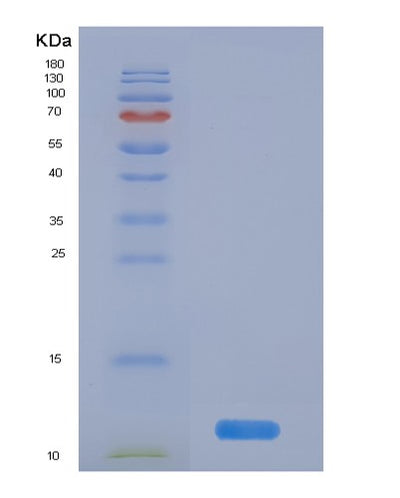 SDS-PAGE analysis of Human UBB (Polyubiquitin-B) - Recombinant Protein, CAT# BLT-03217P, showing >85% purity under 15% SDS-PAGE (Reduced)Human UBB (Polyubiquitin-B) - Recombinant Protein