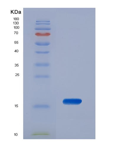 SDS-PAGE analysis of Human TRAPPC2 (Trafficking Protein Particle Complex Subunit 2) - Recombinant Protein, CAT# BLT-03124P, showing >85% purity under 15% SDS-PAGE (Reduced)Human TRAPPC2 (Trafficking Protein Particle Complex Subunit 2) - Recombinant Protein