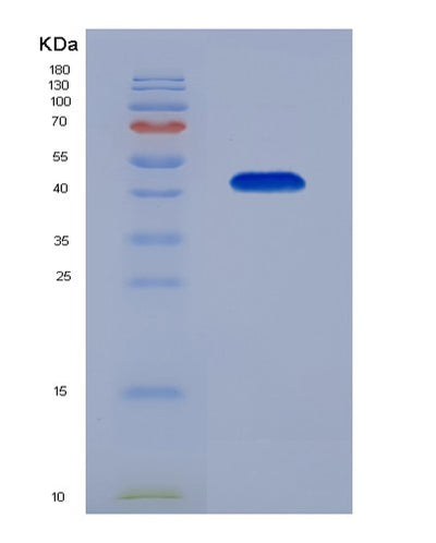 SDS-PAGE analysis of Human CALM1 (Calmodulin-1) - Recombinant Protein, CAT# BLT-03750P, showing >85% purity under 15% SDS-PAGE (Reduced)Human CALM1 (Calmodulin-1) - Recombinant Protein