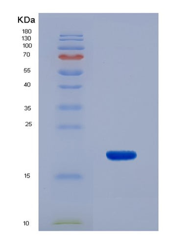 SDS-PAGE analysis of Human CALCB (Calcitonin Gene-Related Peptide 2) - Recombinant Protein, CAT# BLT-07154P, showing >95% purity under 15% SDS-PAGE (Reduced)Human CALCB (Calcitonin Gene-Related Peptide 2) - Recombinant Protein