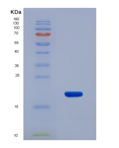 SDS-PAGE analysis of Human CALCB (Calcitonin Gene-Related Peptide 2) - Recombinant Protein, CATHuman CALCB (Calcitonin Gene-Related Peptide 2) - Recombinant Protein