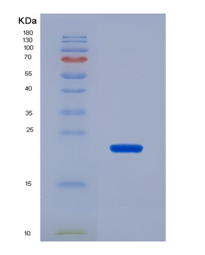 SDS-PAGE analysis of Human SRGN (Serglycin) - Recombinant Protein, CAT# BLT-02867P, showing >85% purity under 15% SDS-PAGE (Reduced)Human SRGN (Serglycin) - Recombinant Protein