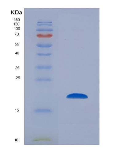 SDS-PAGE analysis of Mouse Ccl2 (C-C Motif Chemokine 2) - Recombinant Protein, CAT# BLT-00441P, showing >85% purity under 15% SDS-PAGE (Reduced)Mouse Ccl2 (C-C Motif Chemokine 2) - Recombinant Protein