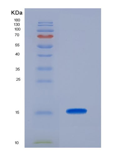 SDS-PAGE analysis of Human RARA (Retinoic Acid Receptor Alpha) - Recombinant Protein, CAT# BLT-02528P, showing >90% purity under 15% SDS-PAGE (Reduced)Human RARA (Retinoic Acid Receptor Alpha) - Recombinant Protein