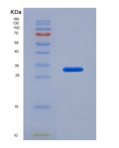 SDS-PAGE analysis of Human HLA-C (Hla Class I Histocompatibility Antigen, C Alpha Chain) - Recombinant Protein, CATHuman HLA-C (Hla Class I Histocompatibility Antigen, C Alpha Chain) - Recombinant Protein