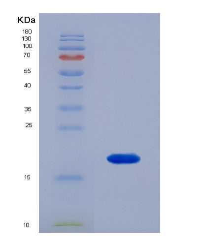 SDS-PAGE analysis of Human RNASE4 (Ribonuclease 4) - Recombinant Protein, CATHuman RNASE4 (Ribonuclease 4) - Recombinant Protein