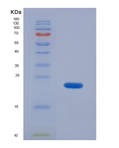 SDS-PAGE analysis of Mouse Ambp (Protein Ambp) - Recombinant Protein, CAT# BLT-07539P, showing >90% purity under 15% SDS-PAGE (Reduced)Mouse Ambp (Protein Ambp) - Recombinant Protein