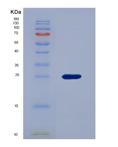 SDS-PAGE analysis of Human YBX1 (Y-Box-Binding Protein 1) - Recombinant Protein, CAT# BLT-07540P, showing >90% purity under 15% SDS-PAGE (Reduced)Human YBX1 (Y-Box-Binding Protein 1) - Recombinant Protein