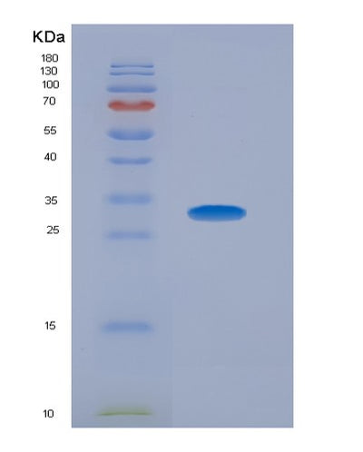 SDS-PAGE analysis of Human SERPIND1 (Heparin Cofactor 2) - Recombinant Protein, CAT# BLT-07541P, showing >90% purity under 15% SDS-PAGE (Reduced)Human SERPIND1 (Heparin Cofactor 2) - Recombinant Protein
