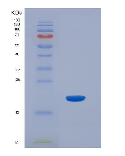 SDS-PAGE analysis of Human CHGA (Chromogranin-A) - Recombinant Protein, CAT# BLT-03272P, showing >85% purity under 15% SDS-PAGE (Reduced)Human CHGA (Chromogranin-A) - Recombinant Protein