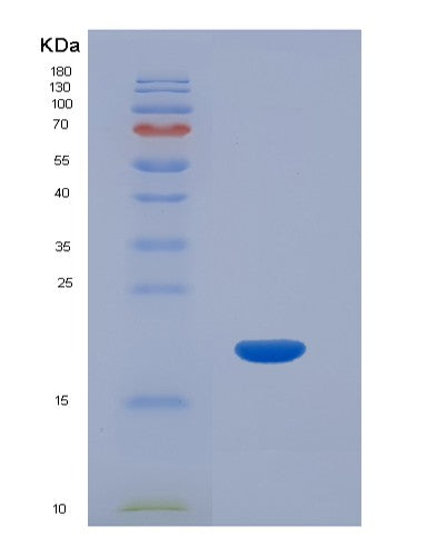SDS-PAGE analysis of Human CHGA (Chromogranin-A) - Recombinant Protein, CATHuman CHGA (Chromogranin-A) - Recombinant Protein