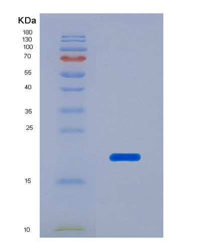 SDS-PAGE analysis of Human HSPD1 (60 Kda Heat Shock Protein, Mitochondrial) - Recombinant Protein, CATHuman HSPD1 (60 Kda Heat Shock Protein, Mitochondrial) - Recombinant Protein