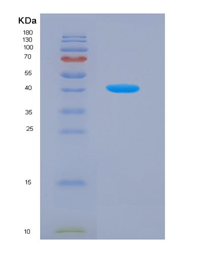 SDS-PAGE analysis of Human P4HA2 (Prolyl 4-Hydroxylase Subunit Alpha-2) - Recombinant Protein, CATHuman P4HA2 (Prolyl 4-Hydroxylase Subunit Alpha-2) - Recombinant Protein