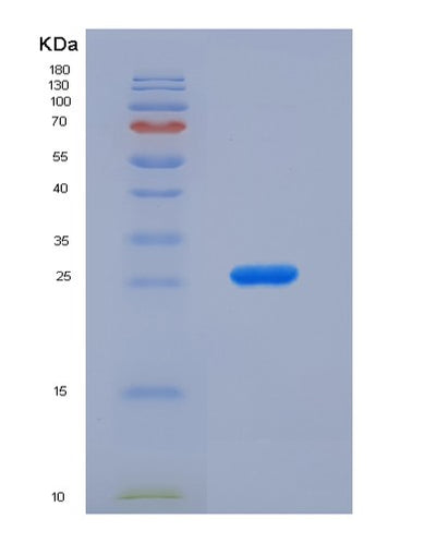 SDS-PAGE analysis of Human CLU (Clusterin) - Recombinant Protein, CAT# BLT-00635P, showing >95% purity under 15% SDS-PAGE (Reduced)Human CLU (Clusterin) - Recombinant Protein