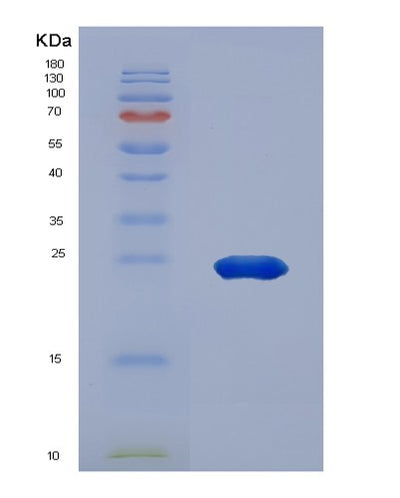 SDS-PAGE analysis of Human HSPA5 (Endoplasmic Reticulum Chaperone Bip) - Recombinant Protein, CAT# BLT-00328P, showing >95% purity under 15% SDS-PAGE (Reduced)Human HSPA5 (Endoplasmic Reticulum Chaperone Bip) - Recombinant Protein