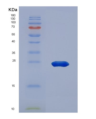SDS-PAGE analysis of Human HSPA5 (Endoplasmic Reticulum Chaperone Bip) - Recombinant Protein, CATHuman HSPA5 (Endoplasmic Reticulum Chaperone Bip) - Recombinant Protein