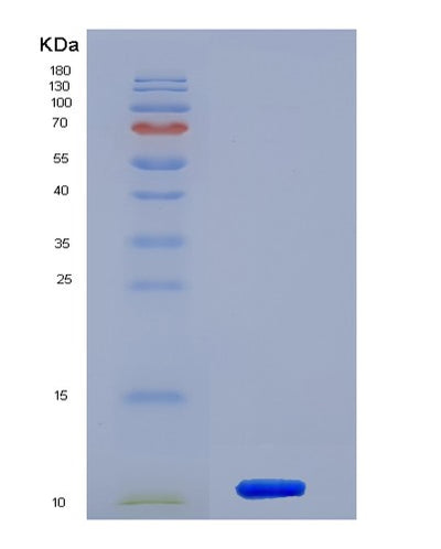 SDS-PAGE analysis of Human HSPA8 (Heat Shock Cognate 71 Kda Protein) - Recombinant Protein, CAT# BLT-01424P, showing >90% purity under 15% SDS-PAGE (Reduced)Human HSPA8 (Heat Shock Cognate 71 Kda Protein) - Recombinant Protein