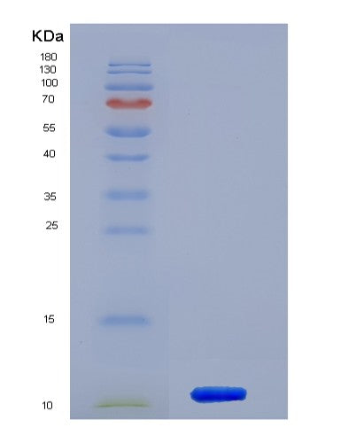 SDS-PAGE analysis of Human HSPA8 (Heat Shock Cognate 71 Kda Protein) - Recombinant Protein, CATHuman HSPA8 (Heat Shock Cognate 71 Kda Protein) - Recombinant Protein