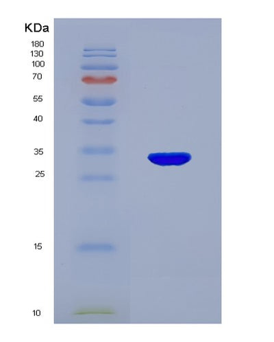 SDS-PAGE analysis of Human UMPS (Uridine 5'-Monophosphate Synthase) - Recombinant Protein, CAT# BLT-03244P, showing >95% purity under 15% SDS-PAGE (Reduced)Human UMPS (Uridine 5'-Monophosphate Synthase) - Recombinant Protein