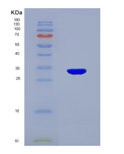 SDS-PAGE analysis of Human UMPS (Uridine 5&Human UMPS (Uridine 5'-Monophosphate Synthase) - Recombinant Protein