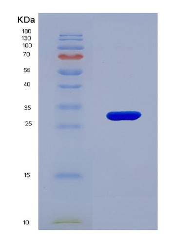 SDS-PAGE analysis of Human ACADM (Medium-Chain Specific Acyl-Coa Dehydrogenase, Mitochondrial) - Recombinant Protein, CAT# BLT-00026P, showing >90% purity under 15% SDS-PAGE (Reduced)Human ACADM (Medium-Chain Specific Acyl-Coa Dehydrogenase, Mitochondrial) - Recombinant Protein
