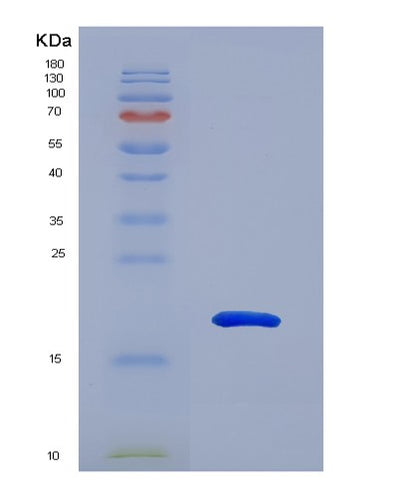 SDS-PAGE analysis of Mouse Mmp9 (Matrix Metalloproteinase-9) - Recombinant Protein, CAT# BLT-07545P, showing >90% purity under 15% SDS-PAGE (Reduced)Mouse Mmp9 (Matrix Metalloproteinase-9) - Recombinant Protein