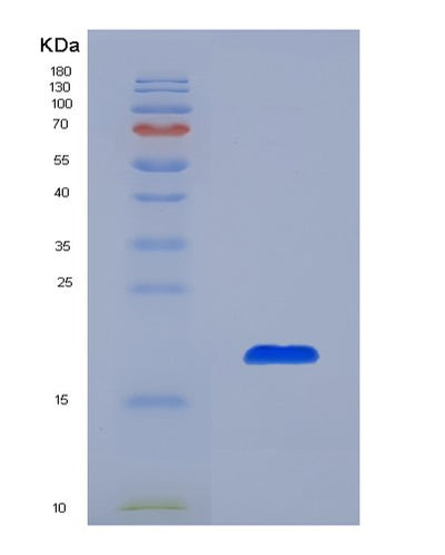 SDS-PAGE analysis of Mouse Crbn (Protein Cereblon) - Recombinant Protein, CAT# BLT-07546P, showing >90% purity under 15% SDS-PAGE (Reduced)Mouse Crbn (Protein Cereblon) - Recombinant Protein