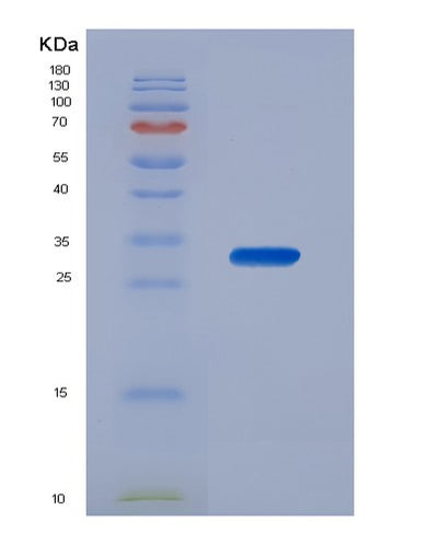 SDS-PAGE analysis of Human CDK4 (Cyclin-Dependent Kinase 4) - Recombinant Protein, CAT# BLT-00545P, showing >90% purity under 15% SDS-PAGE (Reduced)Human CDK4 (Cyclin-Dependent Kinase 4) - Recombinant Protein