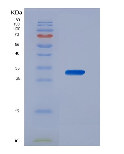 SDS-PAGE analysis of Human CDK4 (Cyclin-Dependent Kinase 4) - Recombinant Protein, CATHuman CDK4 (Cyclin-Dependent Kinase 4) - Recombinant Protein