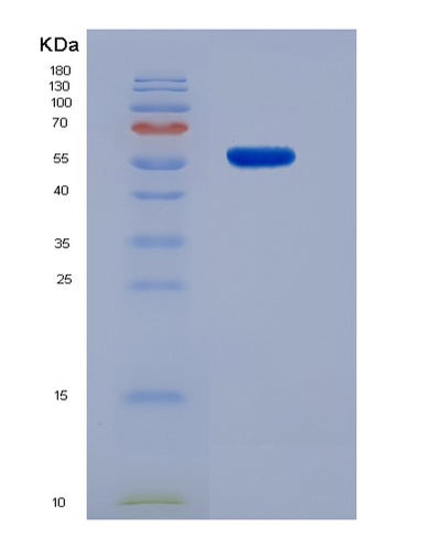 SDS-PAGE analysis of Human PCNA (Proliferating Cell Nuclear Antigen) - Recombinant Protein, CAT# BLT-02172P, showing >95% purity under 15% SDS-PAGE (Reduced)Human PCNA (Proliferating Cell Nuclear Antigen) - Recombinant Protein