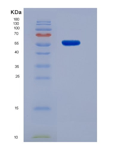 SDS-PAGE analysis of Human PCNA (Proliferating Cell Nuclear Antigen) - Recombinant Protein, CATHuman PCNA (Proliferating Cell Nuclear Antigen) - Recombinant Protein