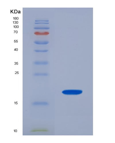 SDS-PAGE analysis of Human FABP2 (Fatty Acid-Binding Protein, Intestinal) - Recombinant Protein, CAT# BLT-01033P, showing >95% purity under 15% SDS-PAGE (Reduced)Human FABP2 (Fatty Acid-Binding Protein, Intestinal) - Recombinant Protein